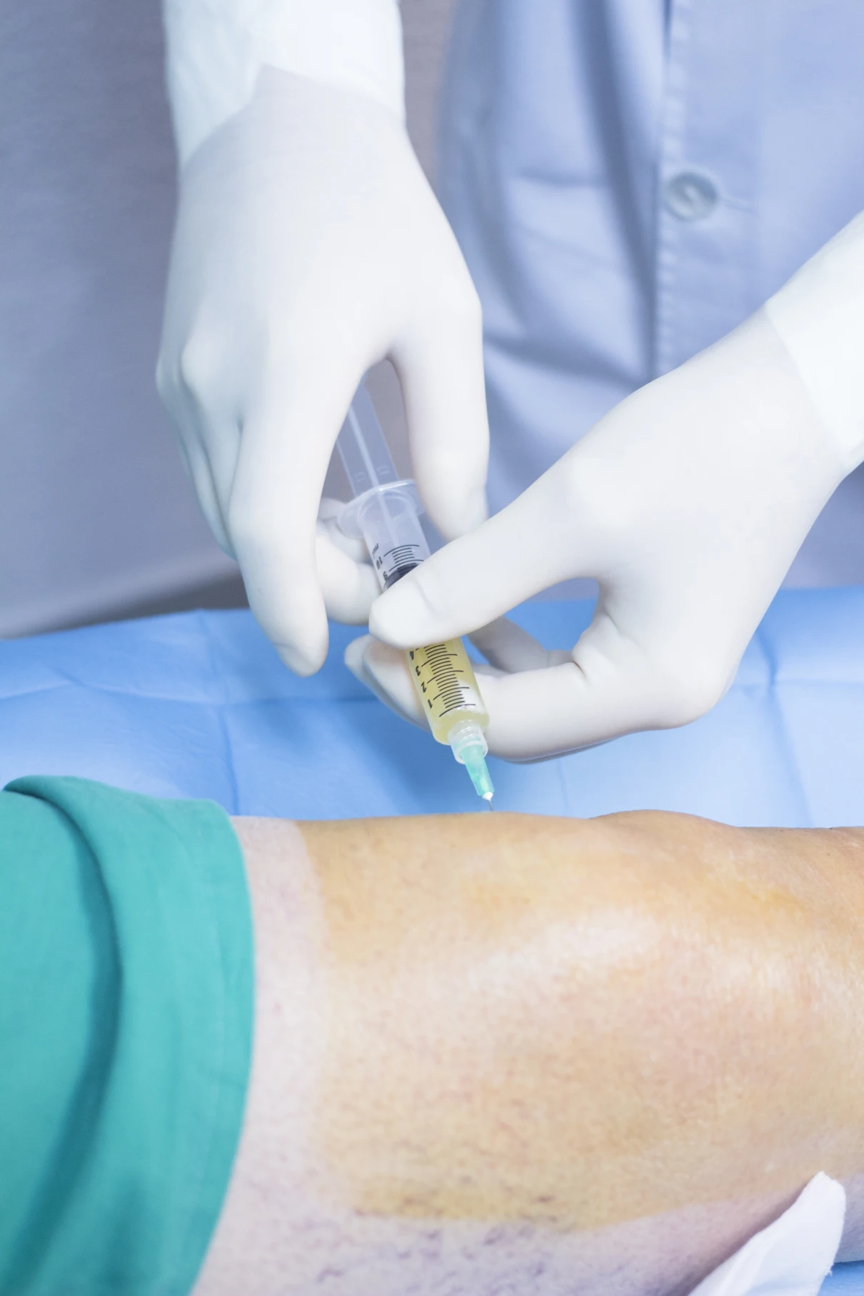 Aplicación de viscosuplementación en rodilla